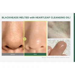 [Anua] Heartleaf Pore Control Cleansing Oil