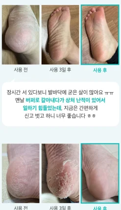 [Ariul] Smooth & Pure Foot Peeling Mask (2 Pairs)
