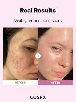 [COSRX] The Niacinamide 15 Serum