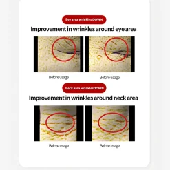 [Dr.Different] VITALIFT-A Eye & Neck